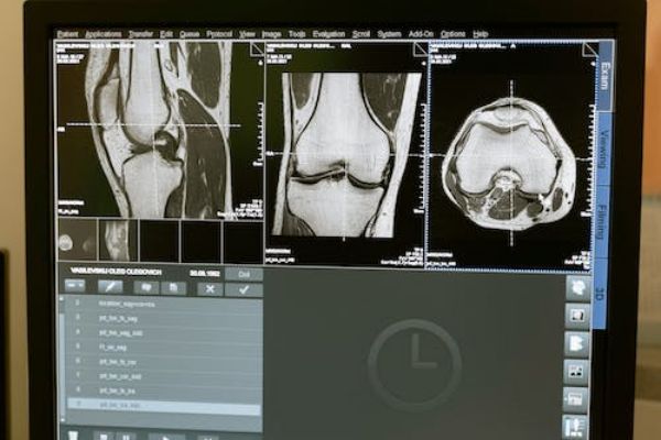 初級社區(qū)工作者考試怎么報名